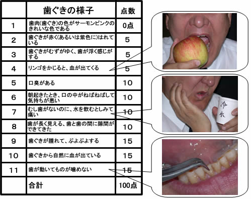 歯周病9
